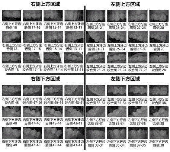 Oral cavity micro viewer application system and full-oral-cavity shooting method