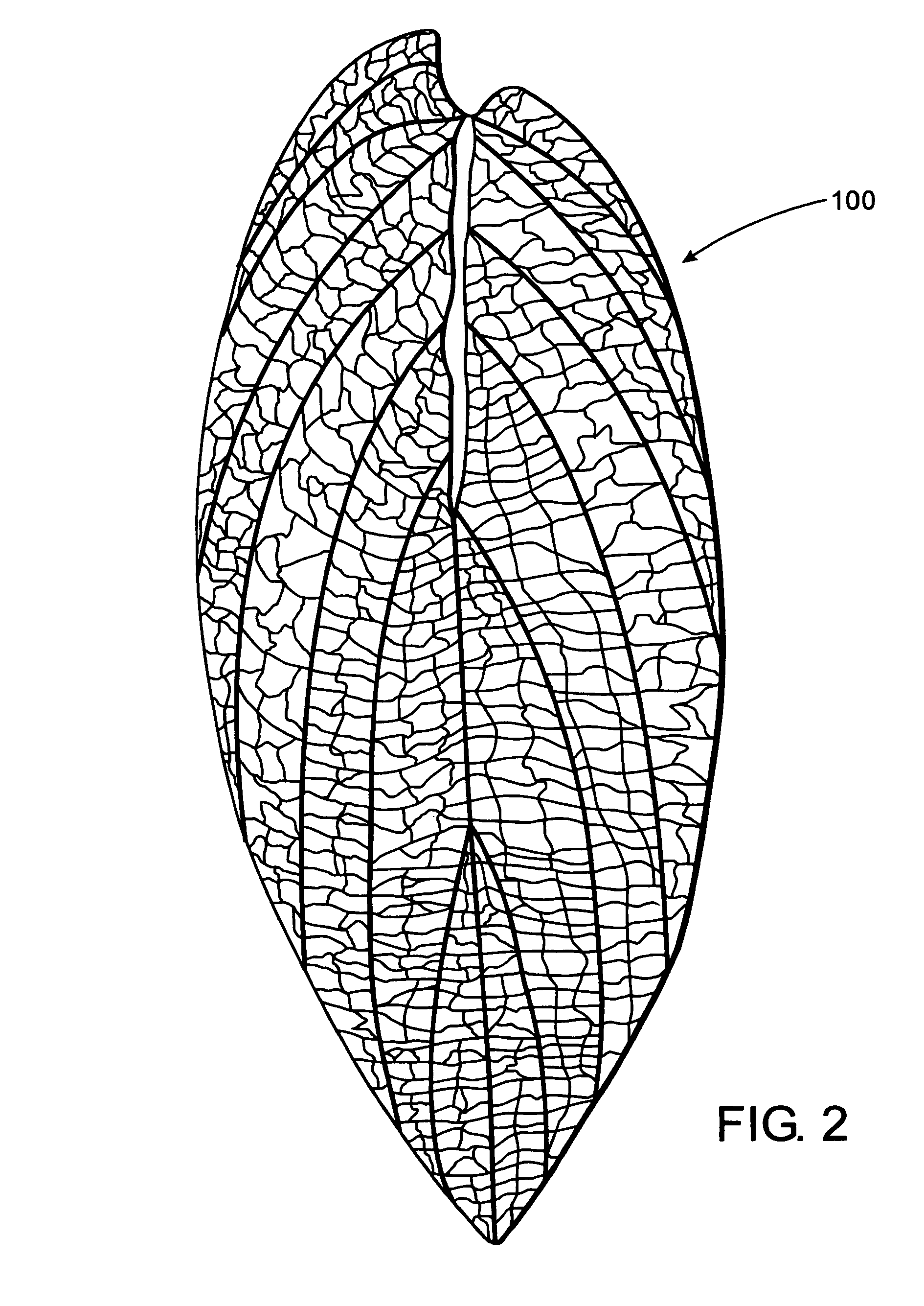 Method for treatment of kidney and/or urinary system stones