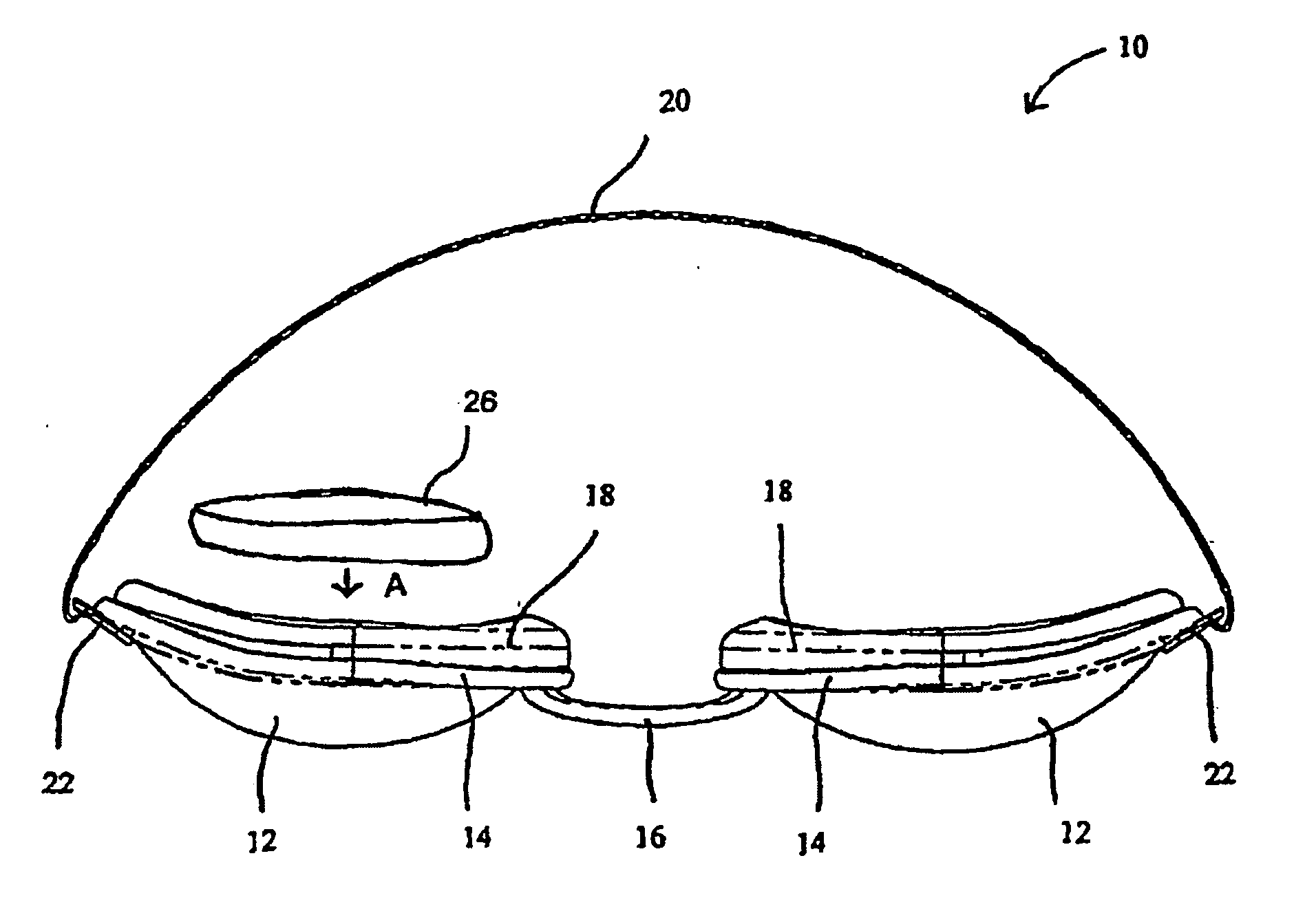 Apparatus, system and method for treating dry eye conditions and promoting healthy eyes