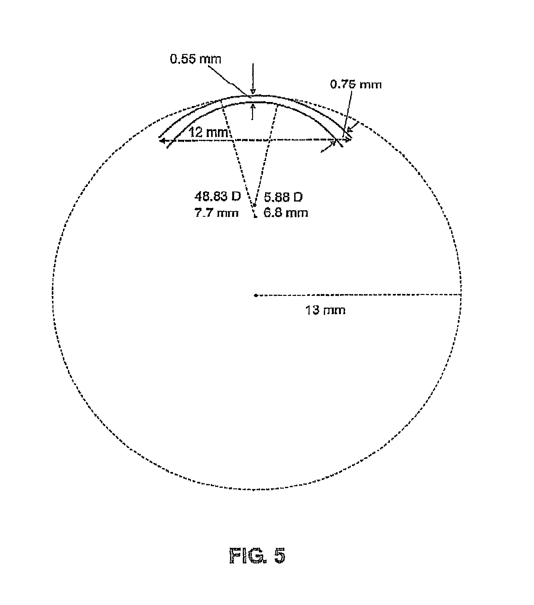 Treatment of ophthalmic conditions