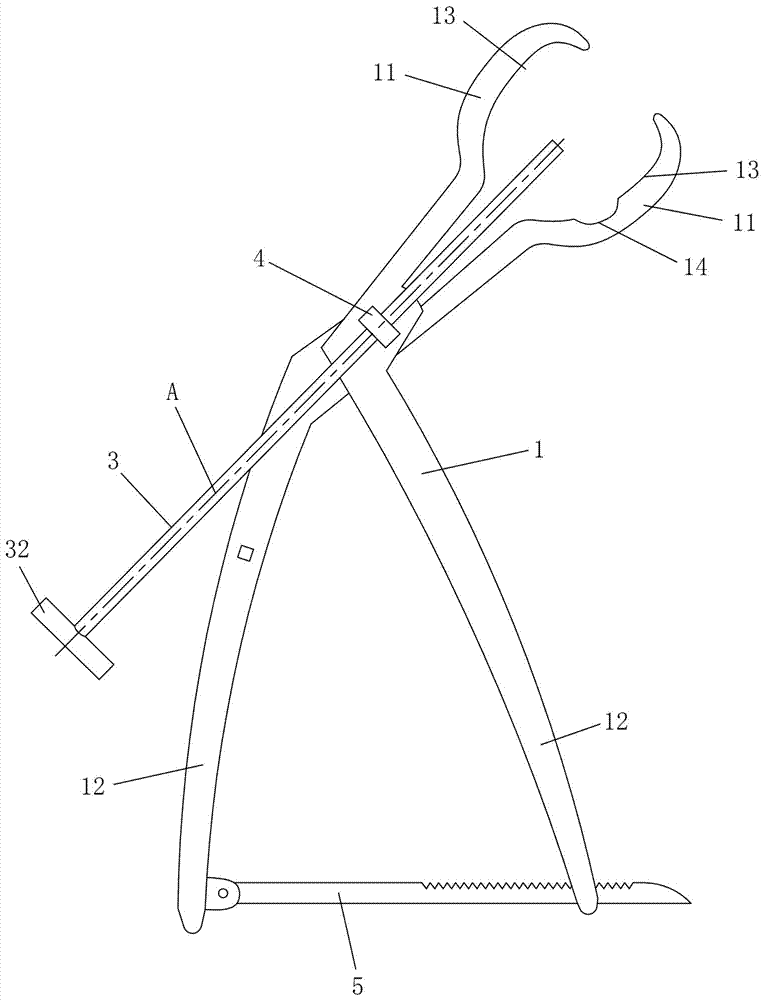 Minimally invasive irreducible syn-intertrochanteric fracture reduction forceps