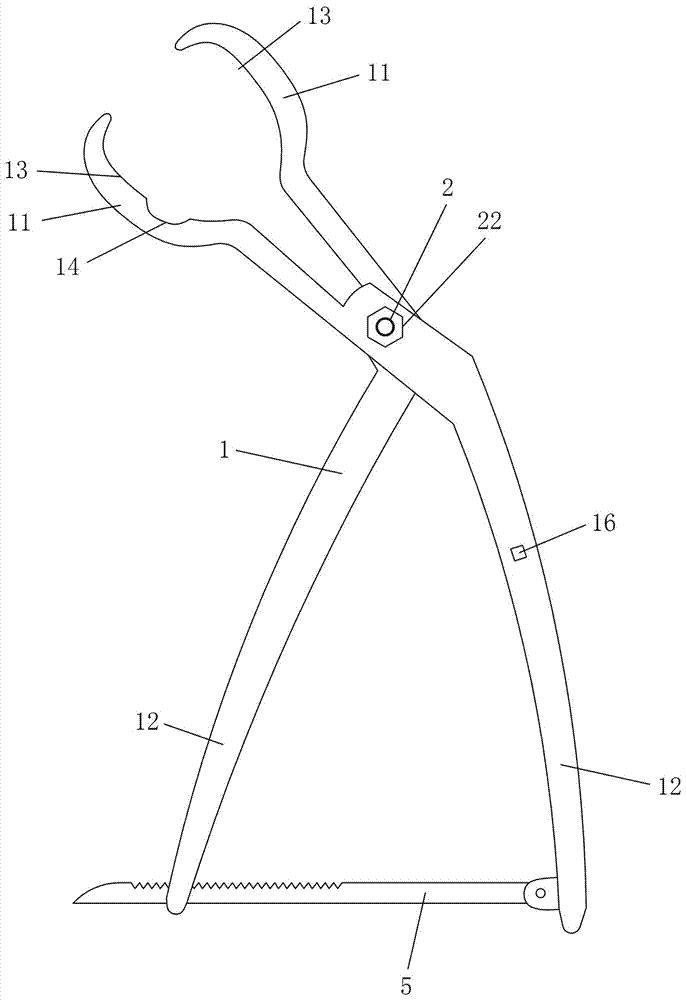 Minimally invasive irreducible syn-intertrochanteric fracture reduction forceps