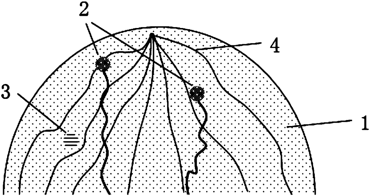 Prosthesis imitating lesion breast, design and preparation method thereof, and method for optimizing or proofreading human breast lesion detection device