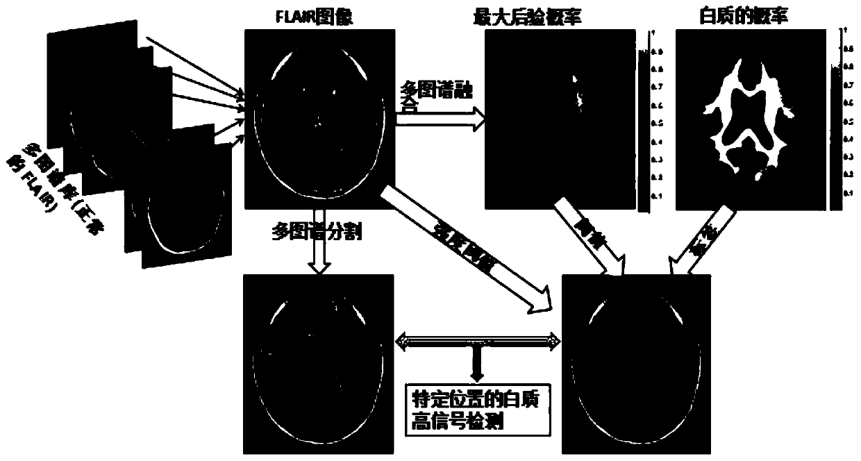 A brain white matter high signal detection and positioning method based on multiple maps