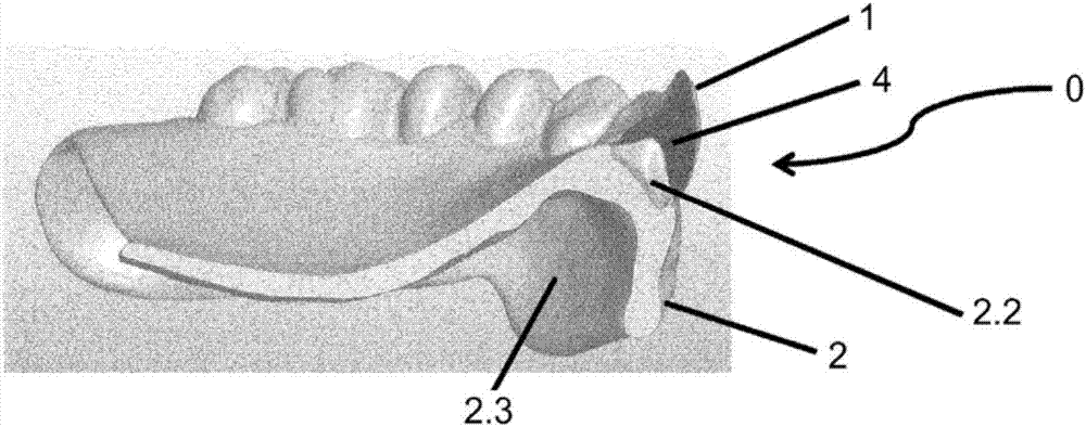 Method for producing partial or total prosthesis, and prosthesis obtainable by this method