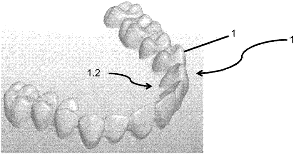 Method for producing partial or total prosthesis, and prosthesis obtainable by this method