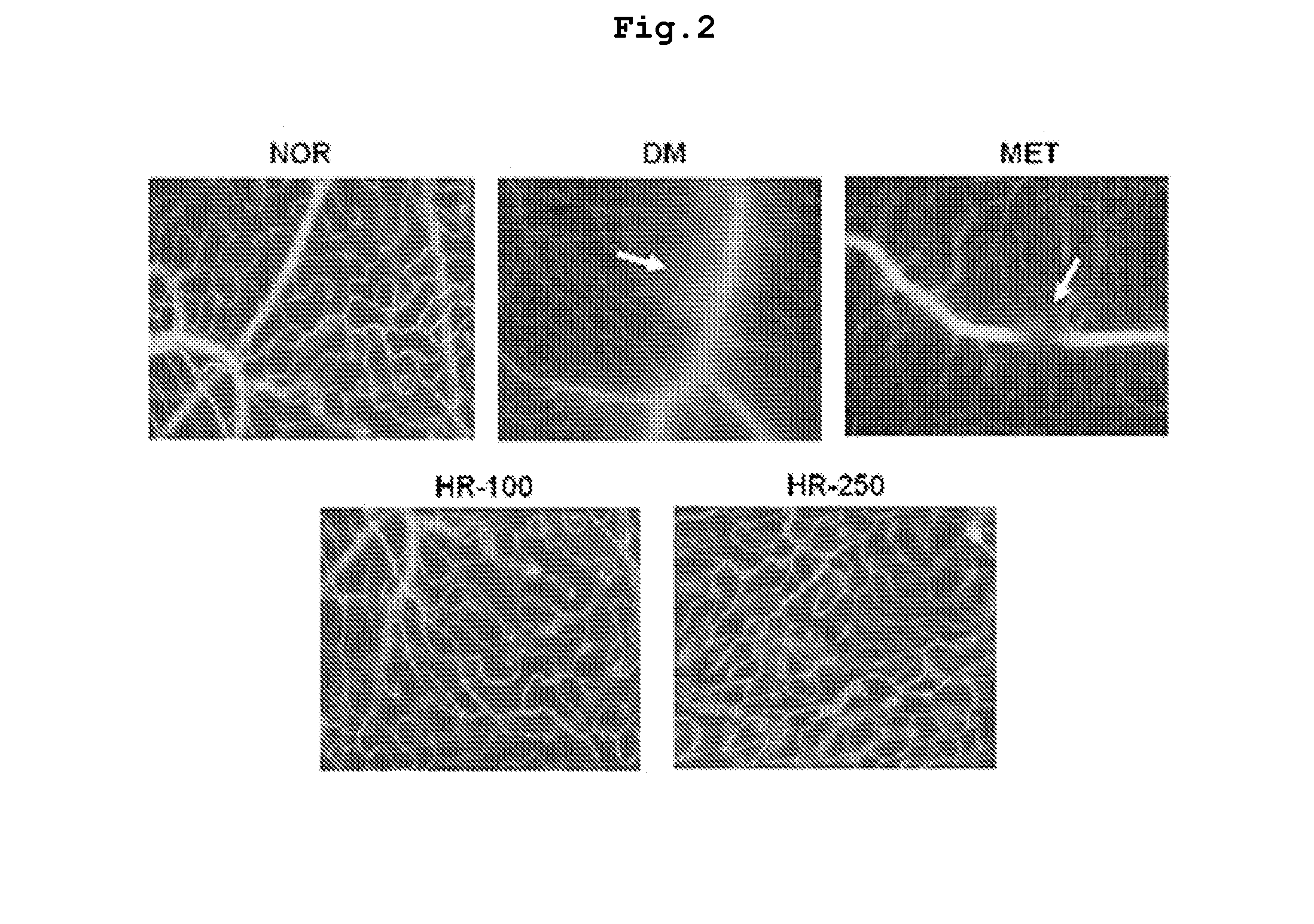 Pharmaceutical composition for preventing and treating complications of  diabetes containing a traditional oriental medicine extract or a fraction thereof as an active ingredient