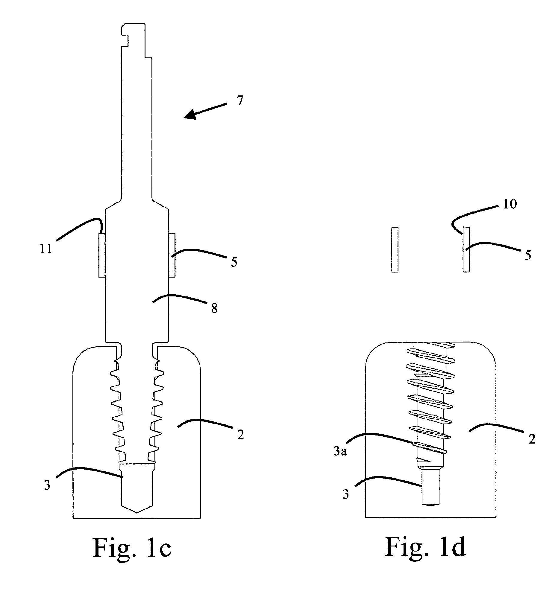 Components for threading of bone