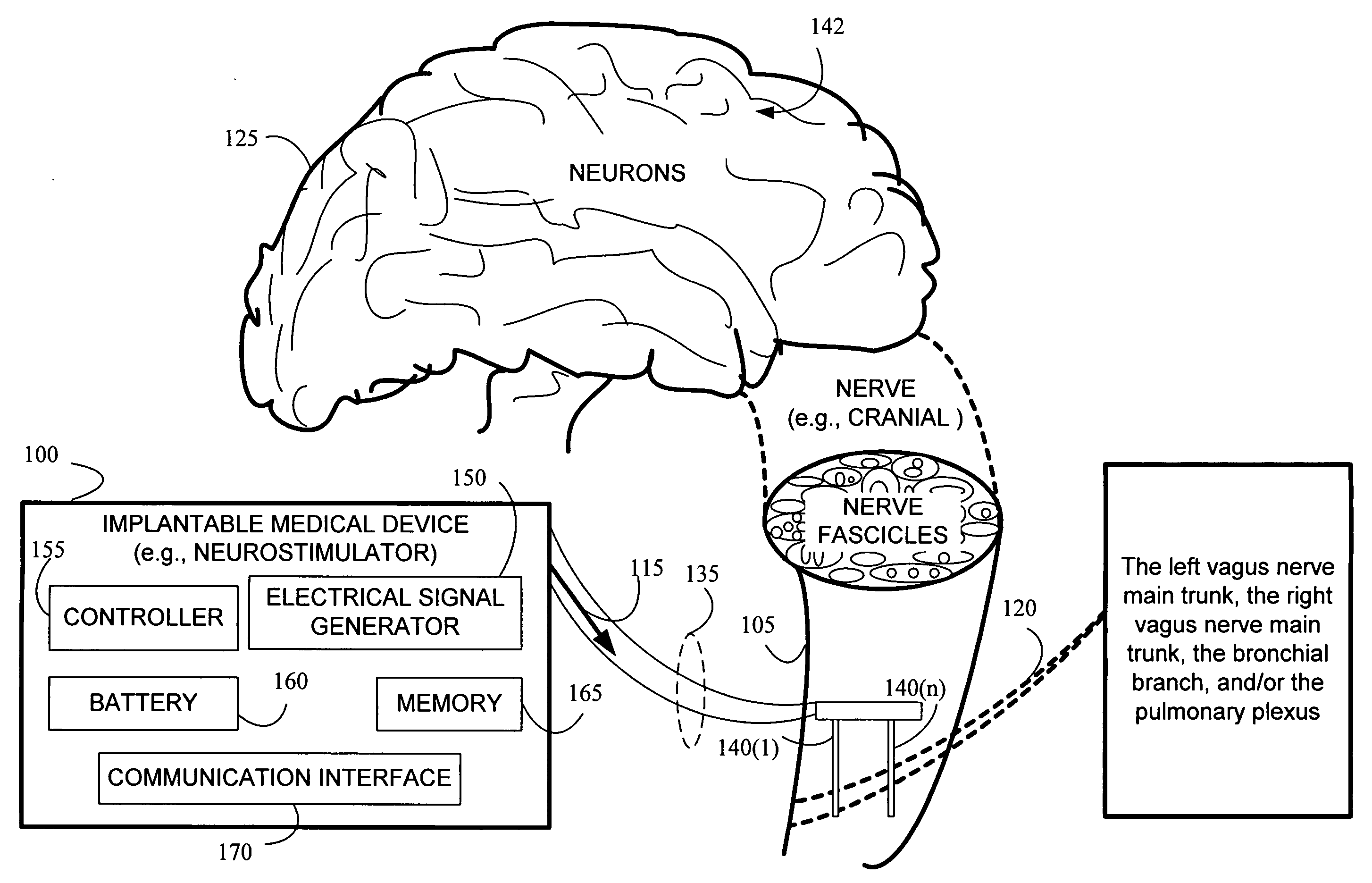 Stimulating cranial nerve to treat pulmonary disorder