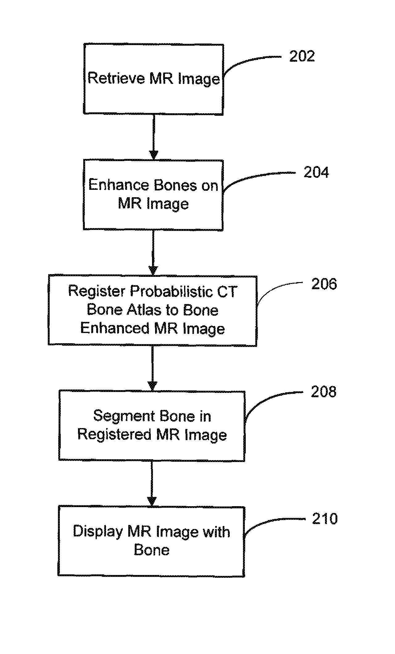 System and method for segmenting bones on MR images