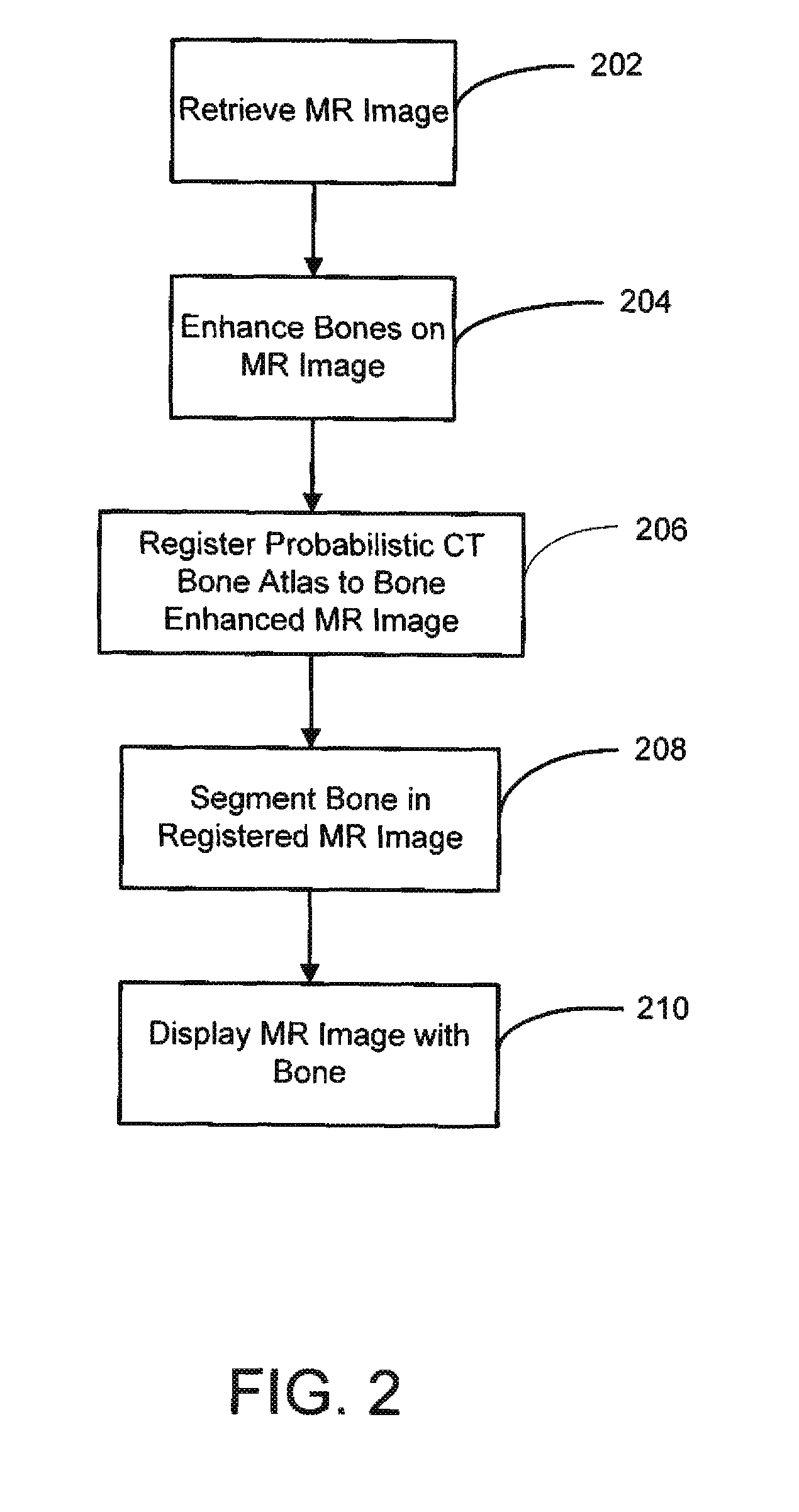 System and method for segmenting bones on MR images