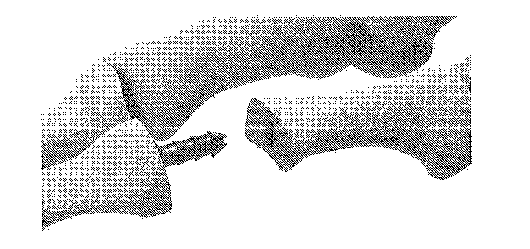 Hammertoe implant