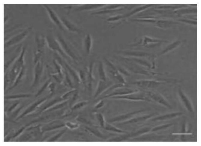 Application of miRNA in preparation of medicine for preventing and treating osteoarthritis, exosome with high expression of miRNA, and application of exosome