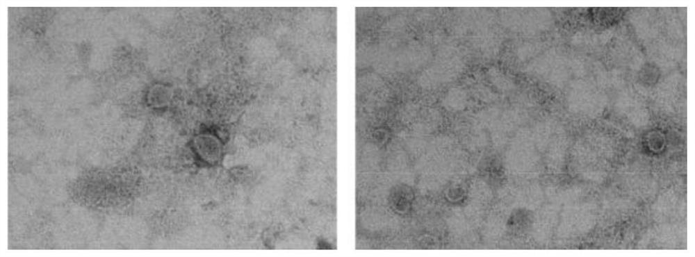 Application of miRNA in preparation of medicine for preventing and treating osteoarthritis, exosome with high expression of miRNA, and application of exosome