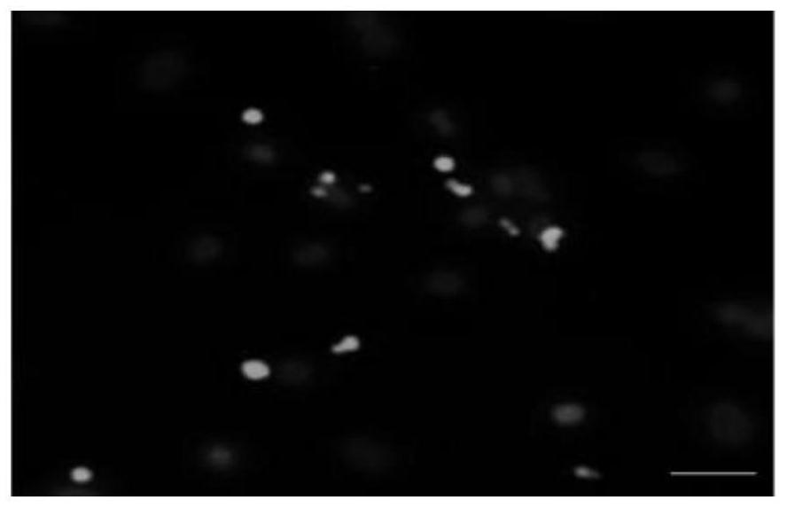 Application of miRNA in preparation of medicine for preventing and treating osteoarthritis, exosome with high expression of miRNA, and application of exosome