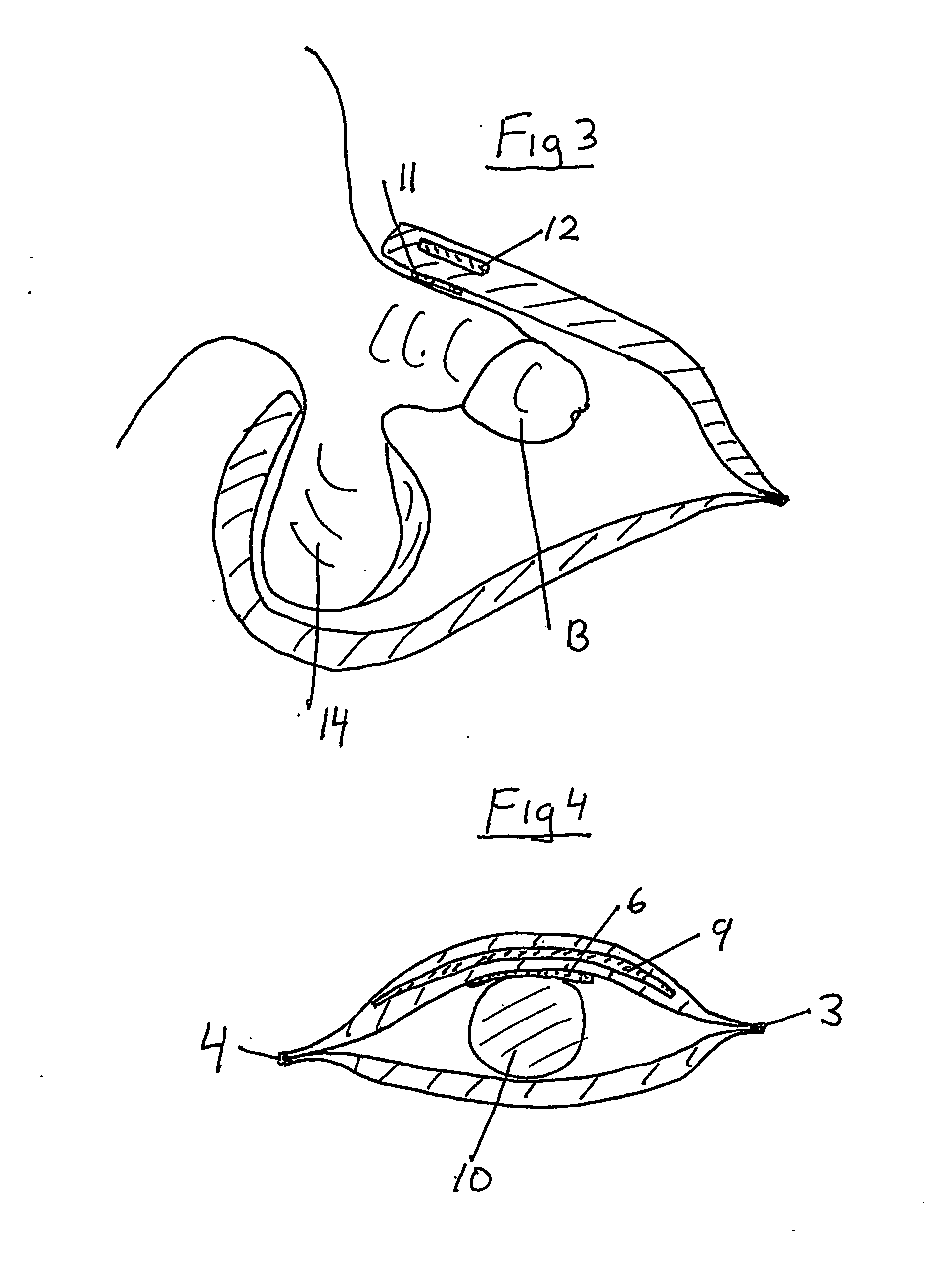 Incontinence protection device for men