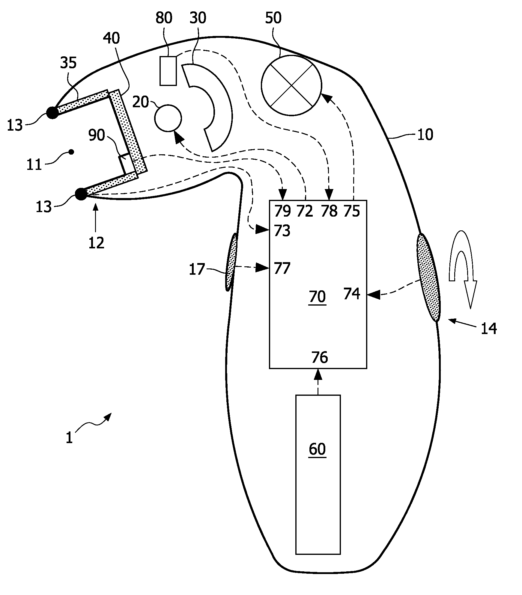 Photo-epilation device