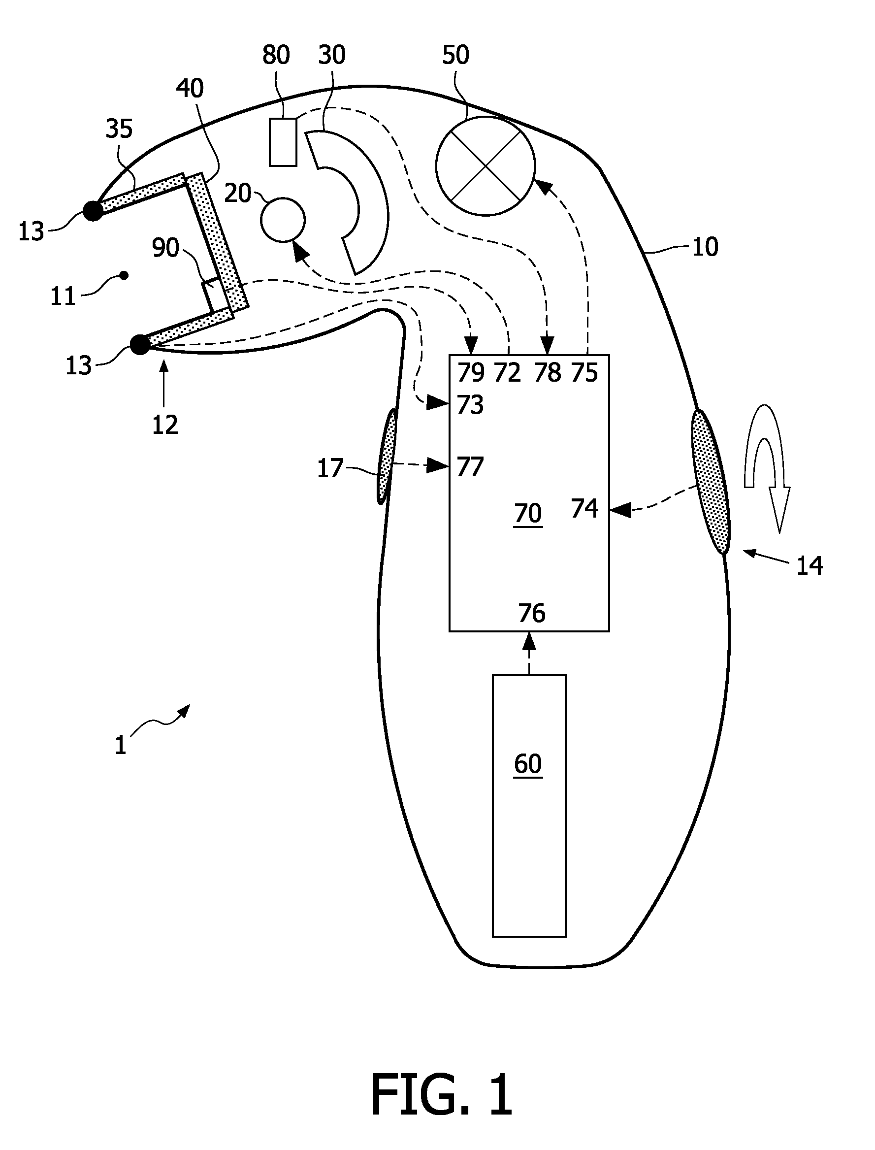 Photo-epilation device