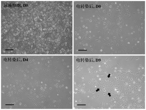 Specific induced pluripotent stem cell line containing CLCN2 homozygous mutation for leukoencephalopathy patients