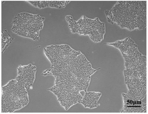 Specific induced pluripotent stem cell line containing CLCN2 homozygous mutation for leukoencephalopathy patients