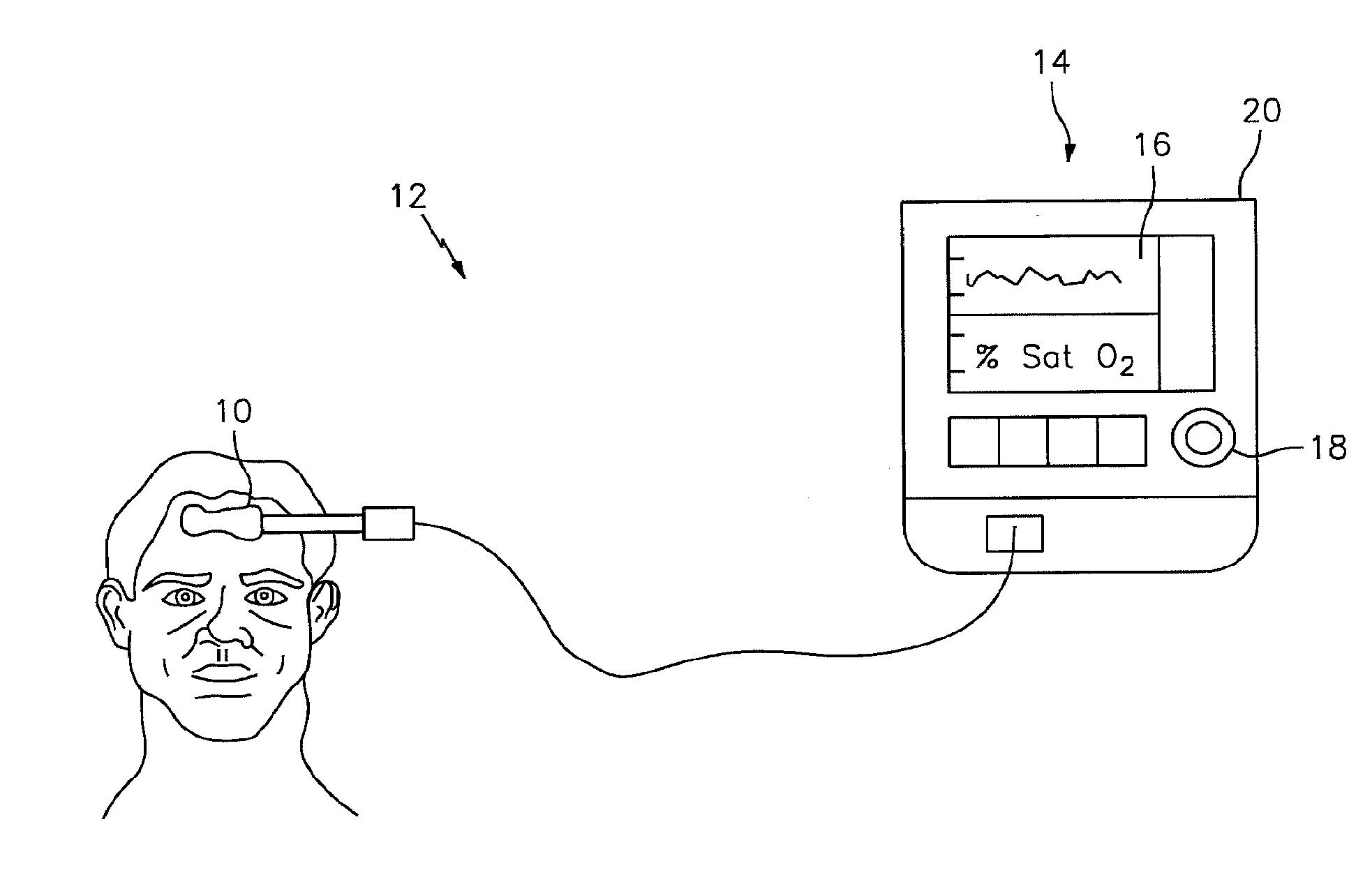 Method for spectrophotometrically determining a blood oxygen parameter