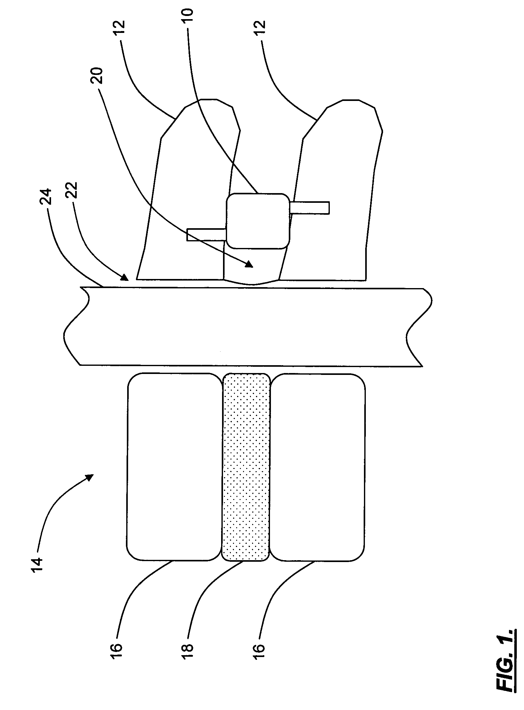 Interspinous distraction devices and associated methods of insertion