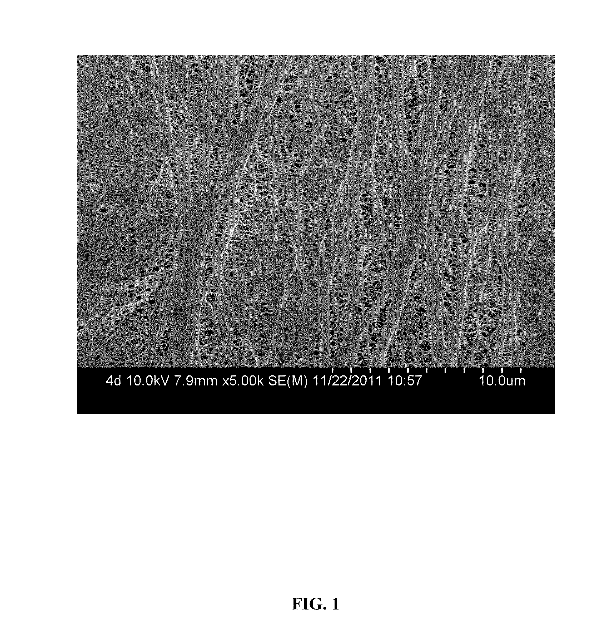 Microporous membrane of polyethylene-based composite material and preparation method thereof