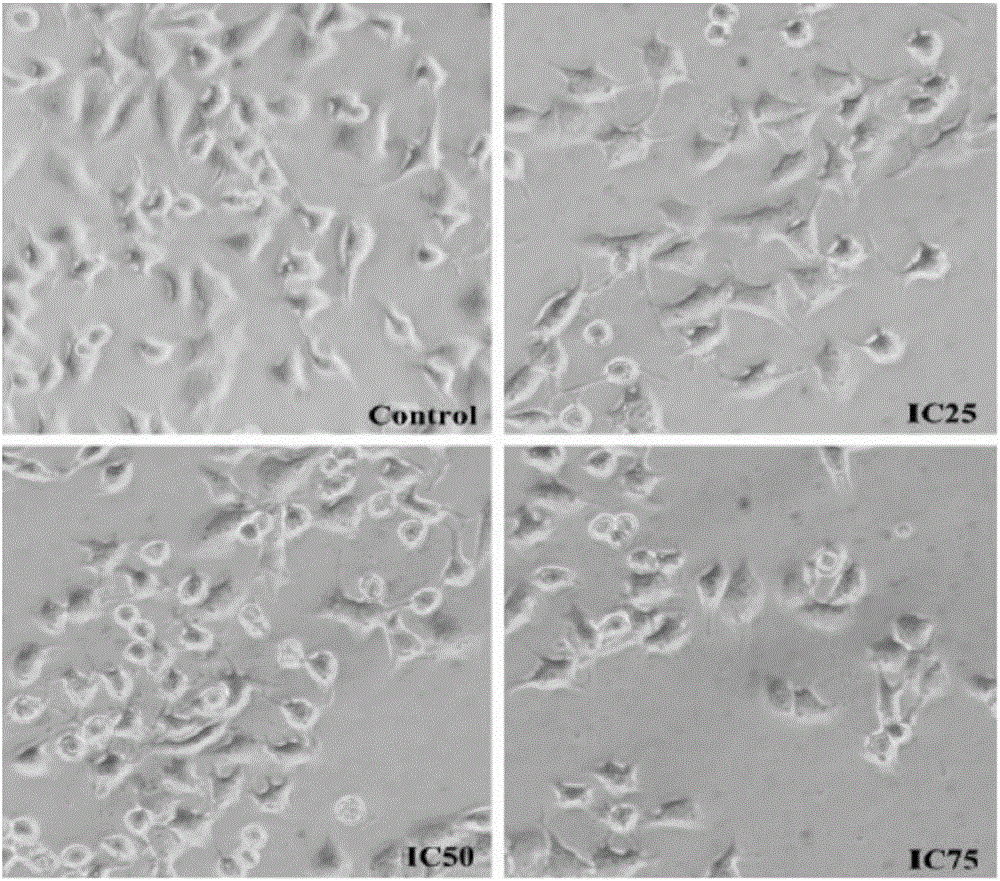 intervention effect of cyanidin-3-o-glucoside on reproductive toxicities of acrylamide and glycidamide