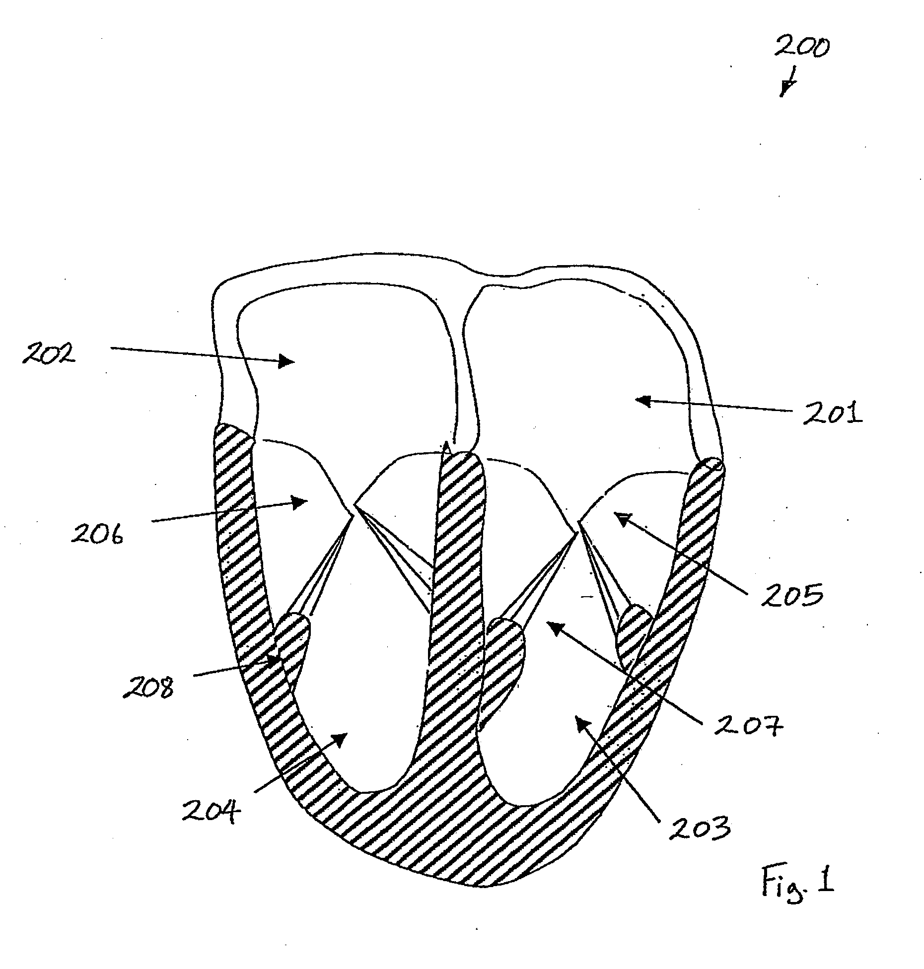 Medical device suitable for use in treatment of a valve