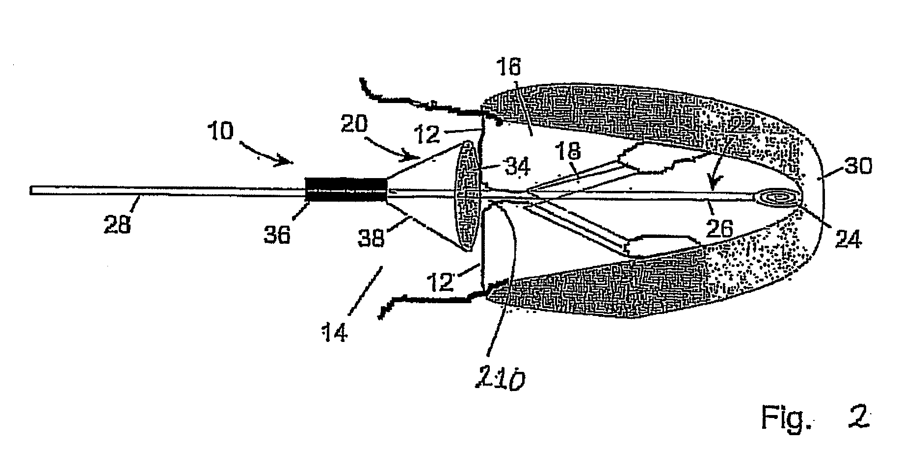 Medical device suitable for use in treatment of a valve