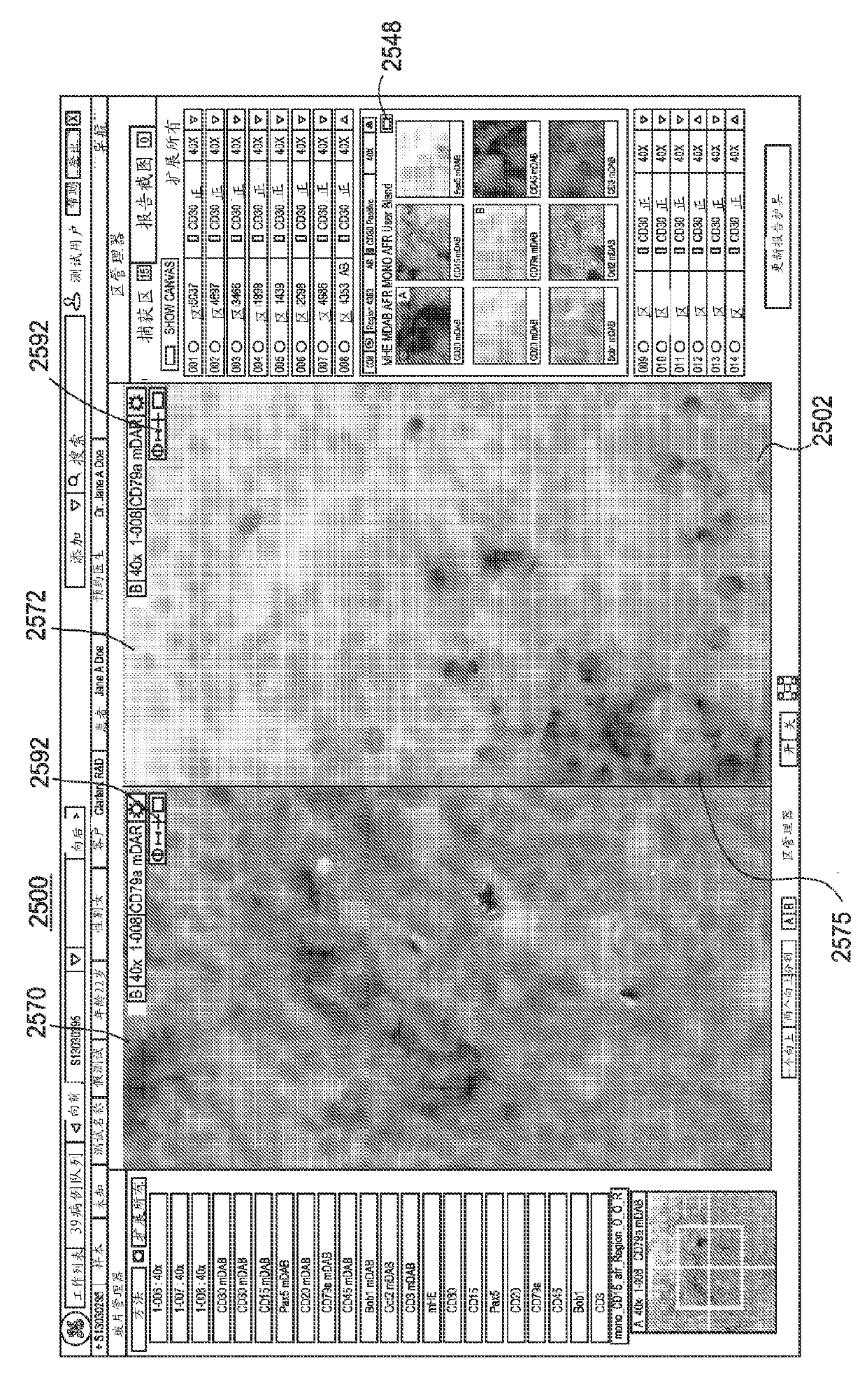 Selection and display of biomarker expressions