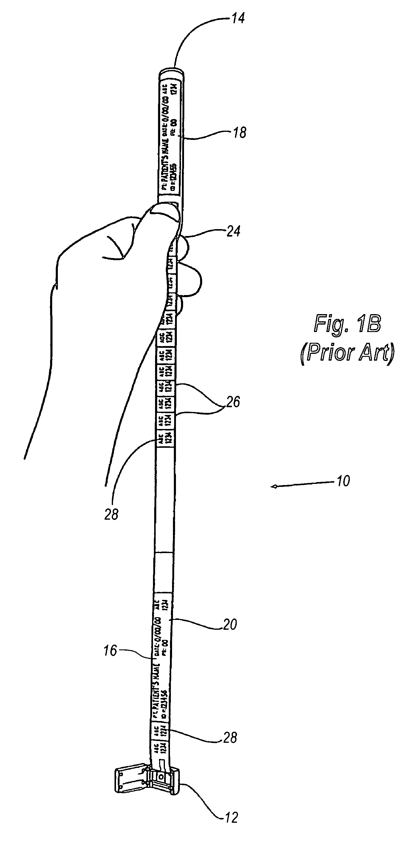 Removable patient identification strap for blood recipient verification