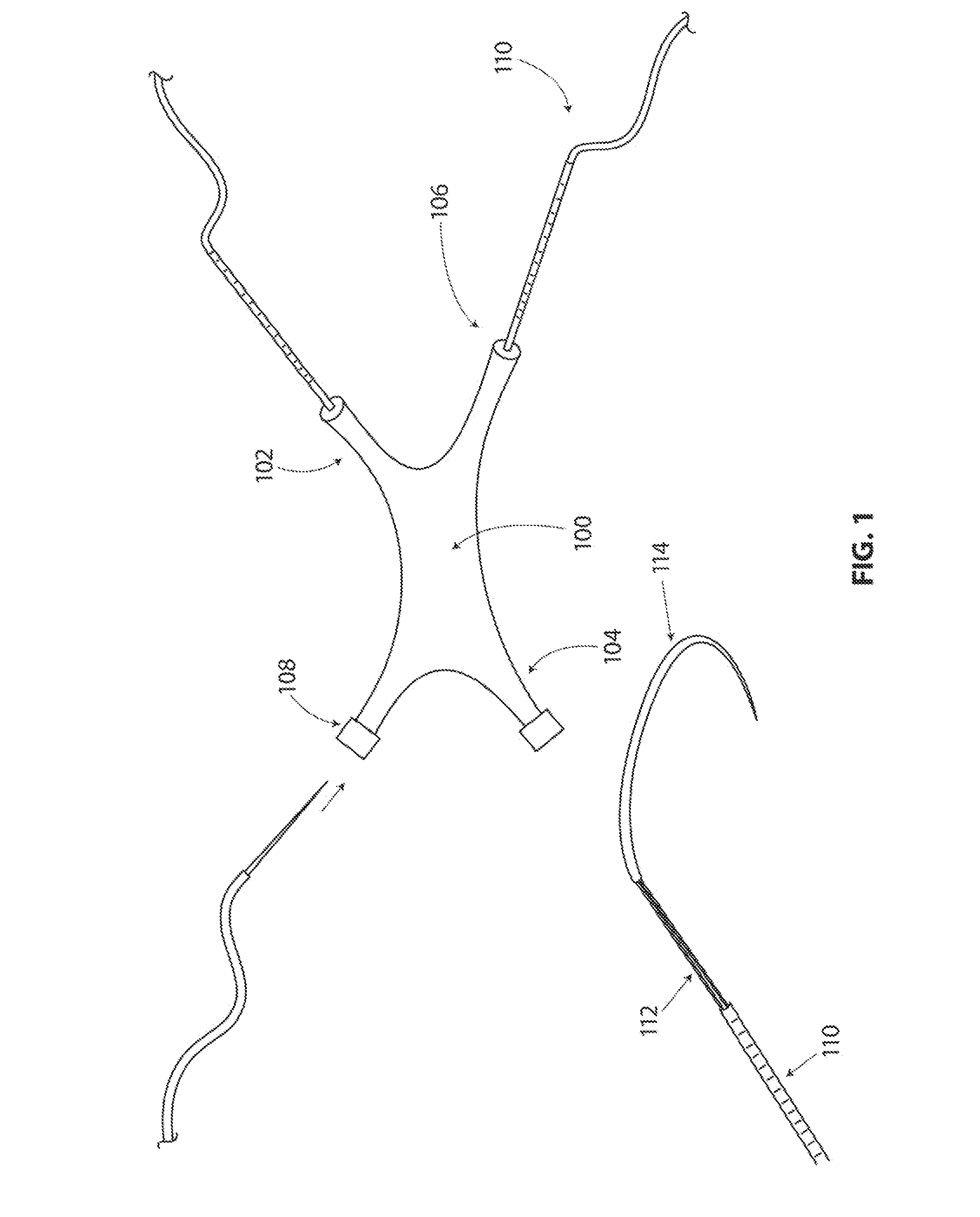 Systems and methods for sternum repair