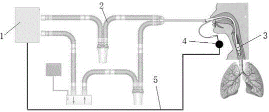 Special breathing machine for accurately controlling pressure of artificial airway airbag based on breathing machine waveform