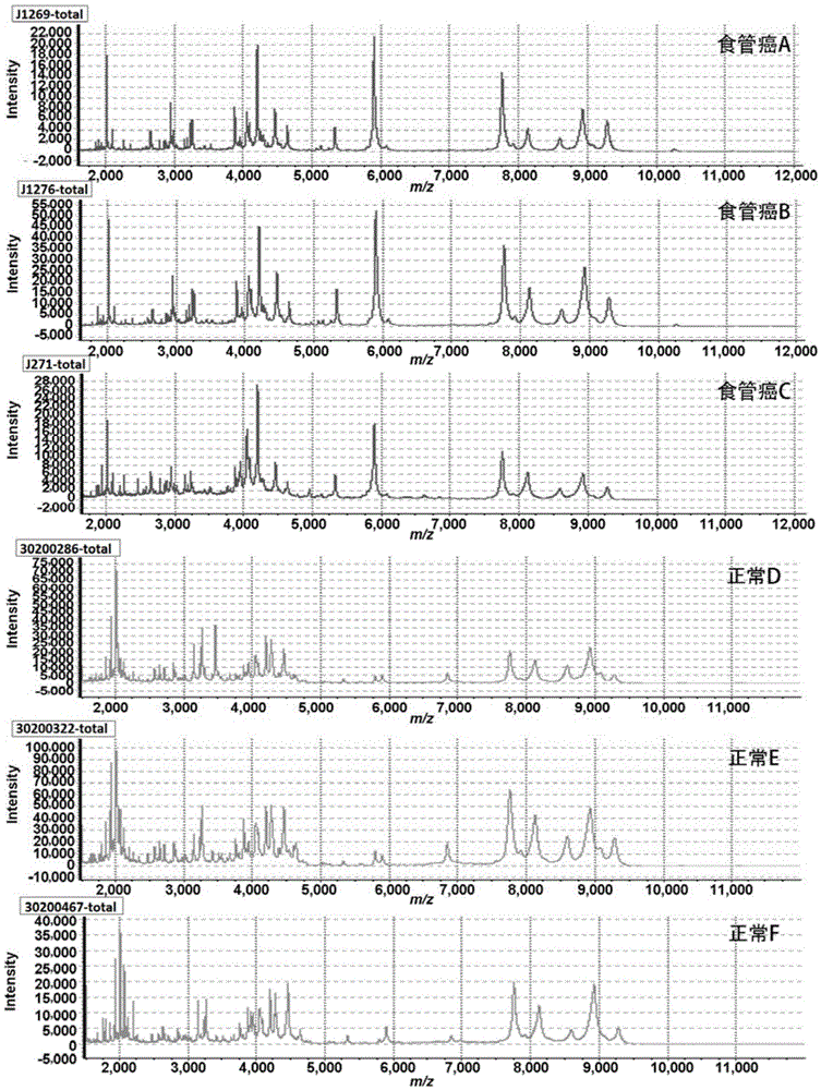 Biomarker for detecting esophagus cancer