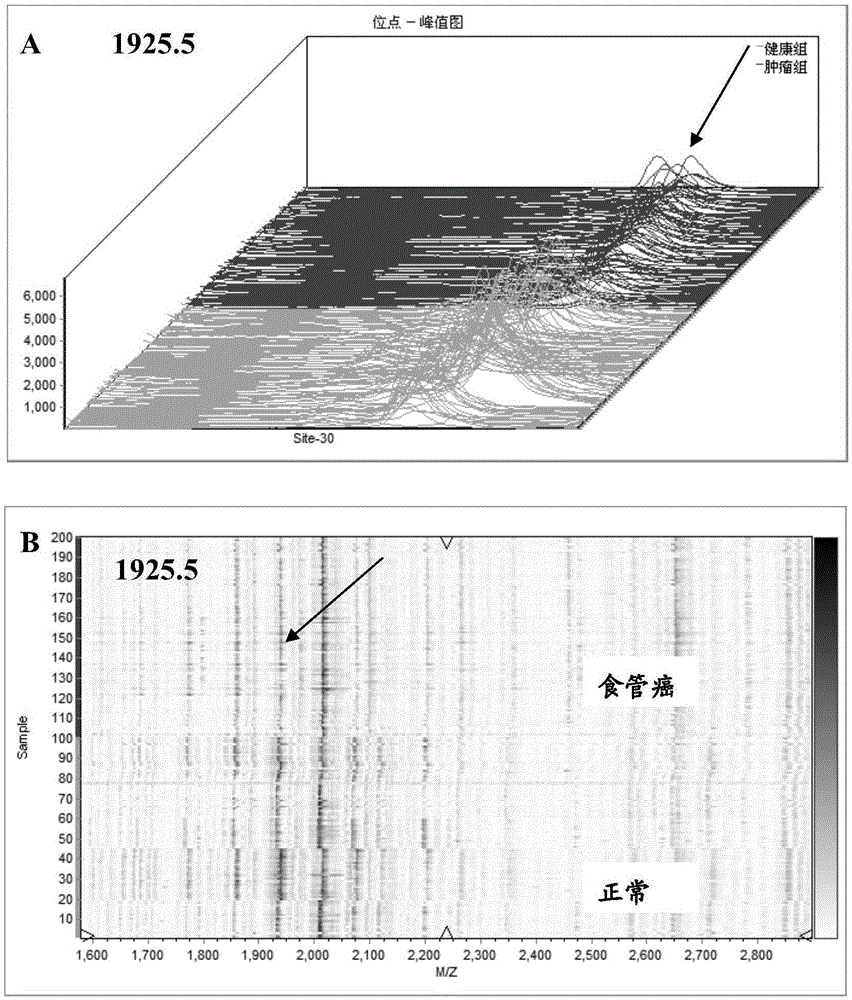 Biomarker for detecting esophagus cancer