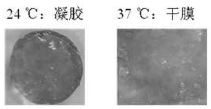 Dry film dressing for promoting quick healing of diabetic refractory wounds and preparation method of dry film dressing