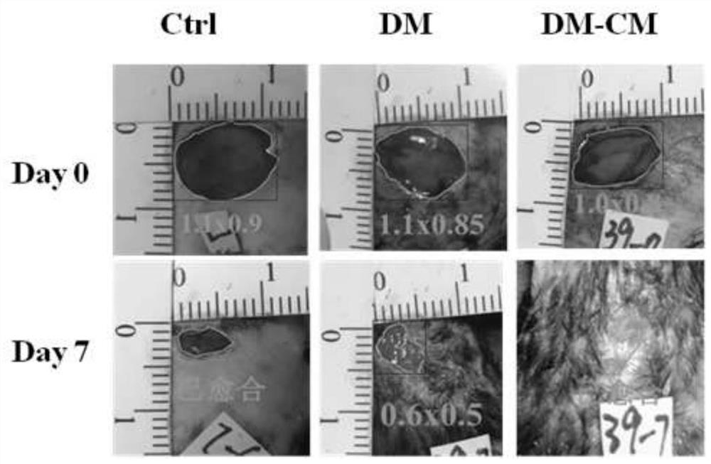 Dry film dressing for promoting quick healing of diabetic refractory wounds and preparation method of dry film dressing