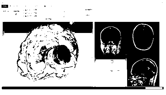 Neurosurgery brain operation typical medical history training system