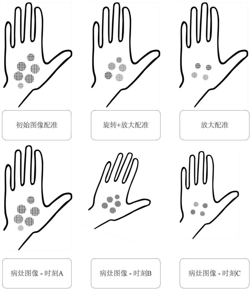 A method and system for automatic evaluation of skin disease treatment effect