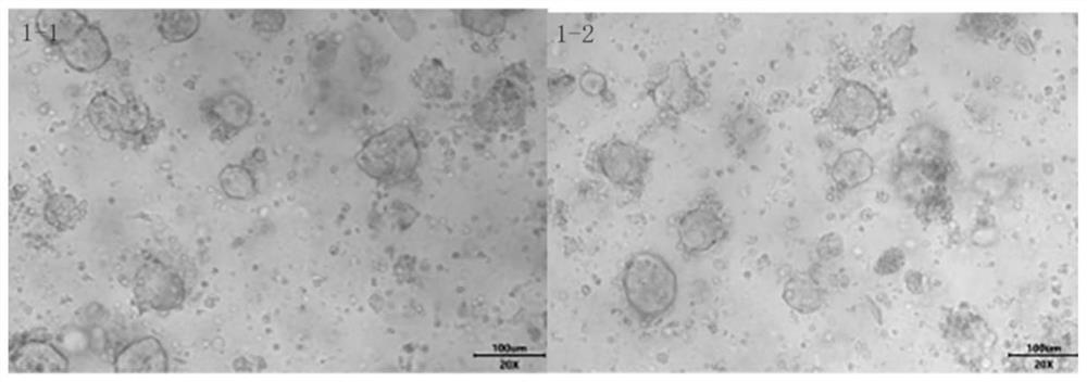 Organoid culture medium material and preparation method and application thereof