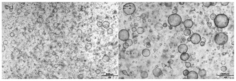 Organoid culture medium material and preparation method and application thereof