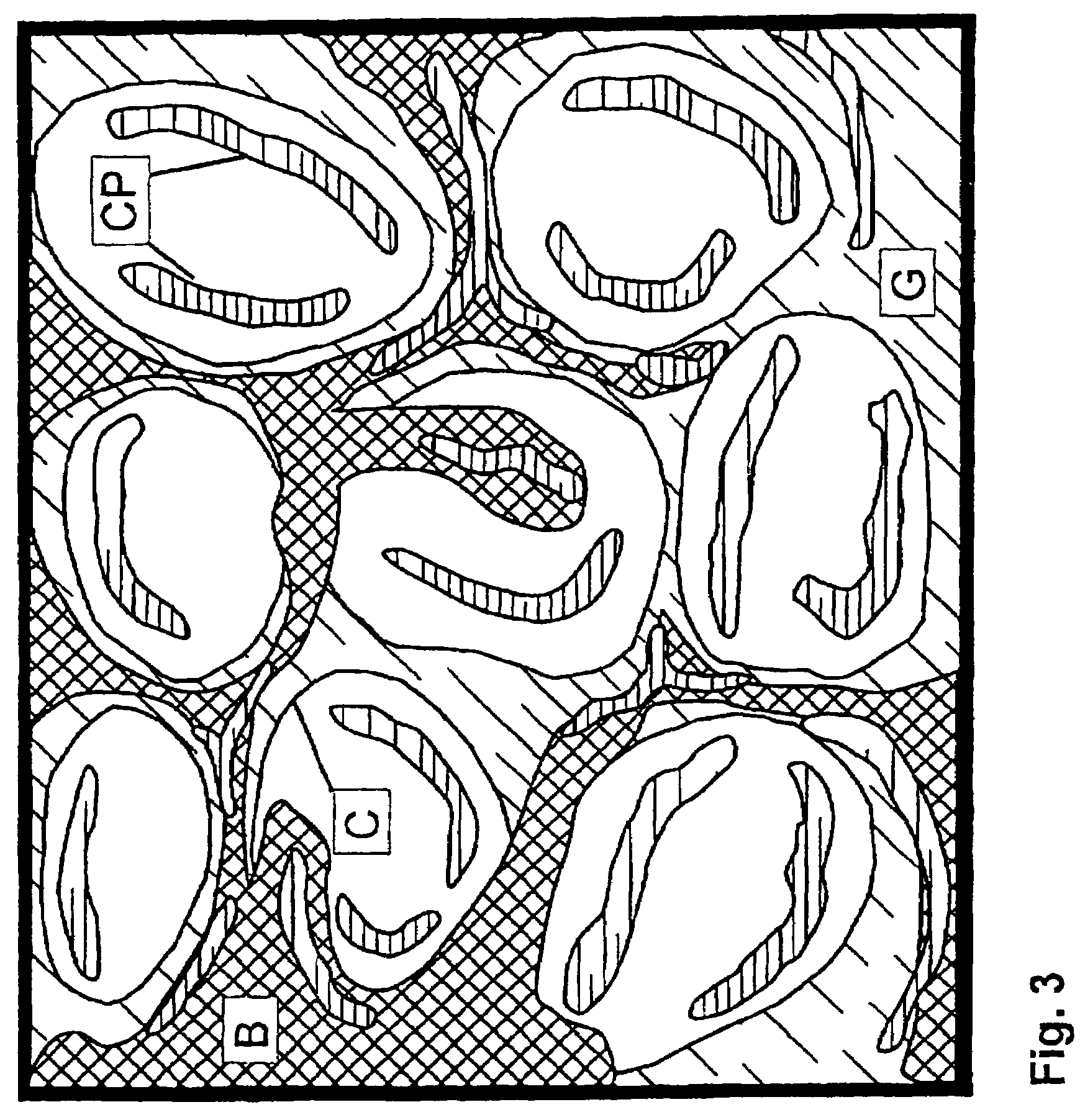 Method for manufacturing particles for use in forming a resorbable implant for stimulating bone growth