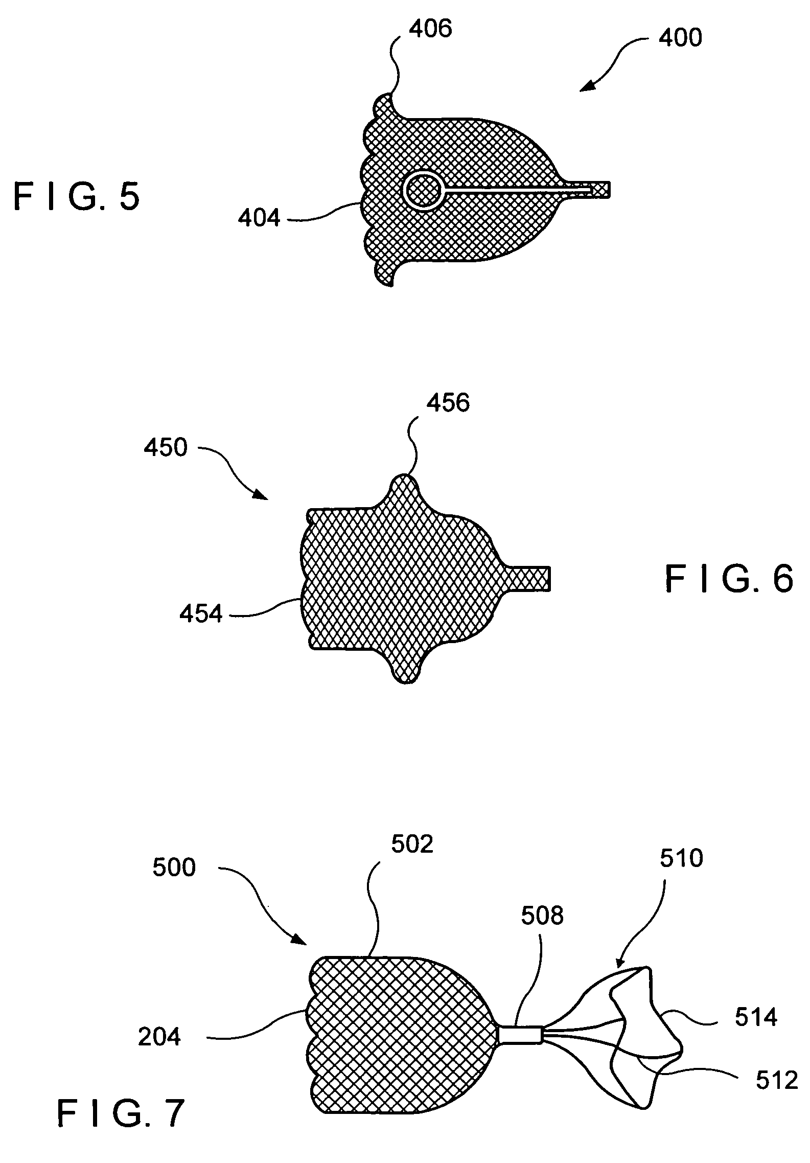 Bronchoscopic lung volume reduction valve