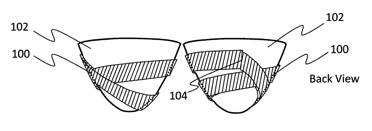 Cardiac assist system using helical arrangement of contractile bands and helically-twisting cardiac assist device