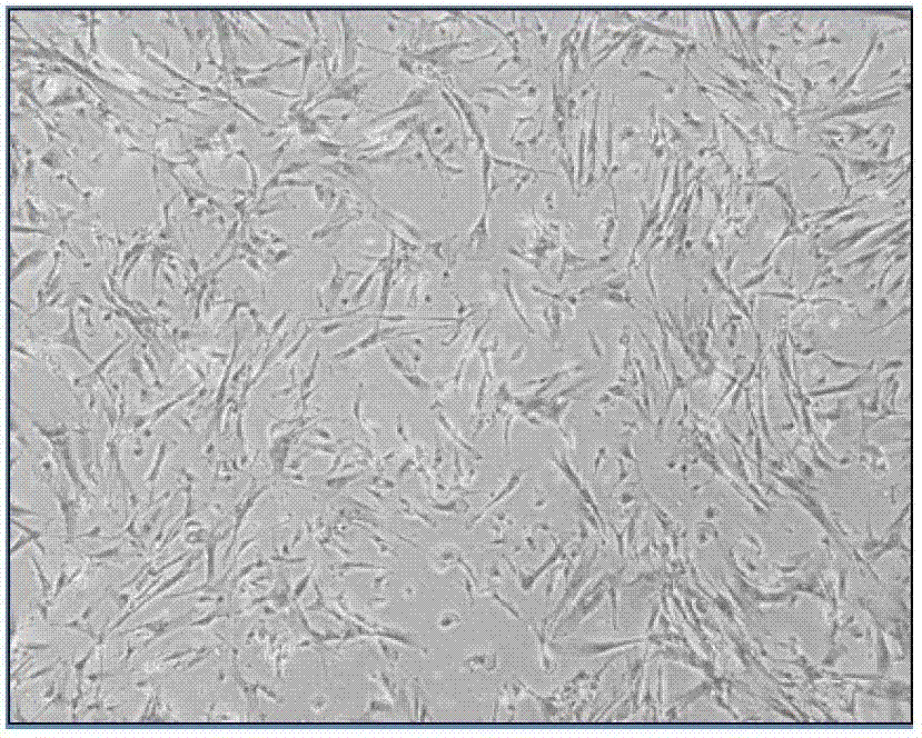 Preparation method and application of tissue-engineering human tooth root implantation material