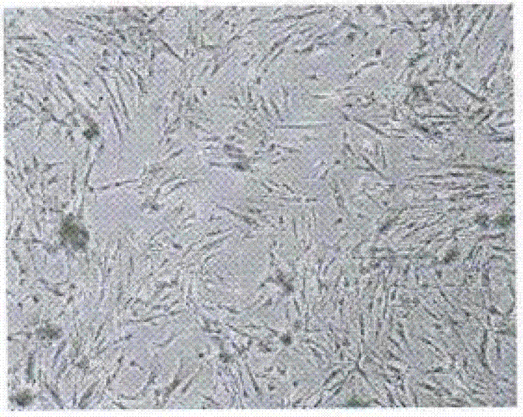 Preparation method and application of tissue-engineering human tooth root implantation material