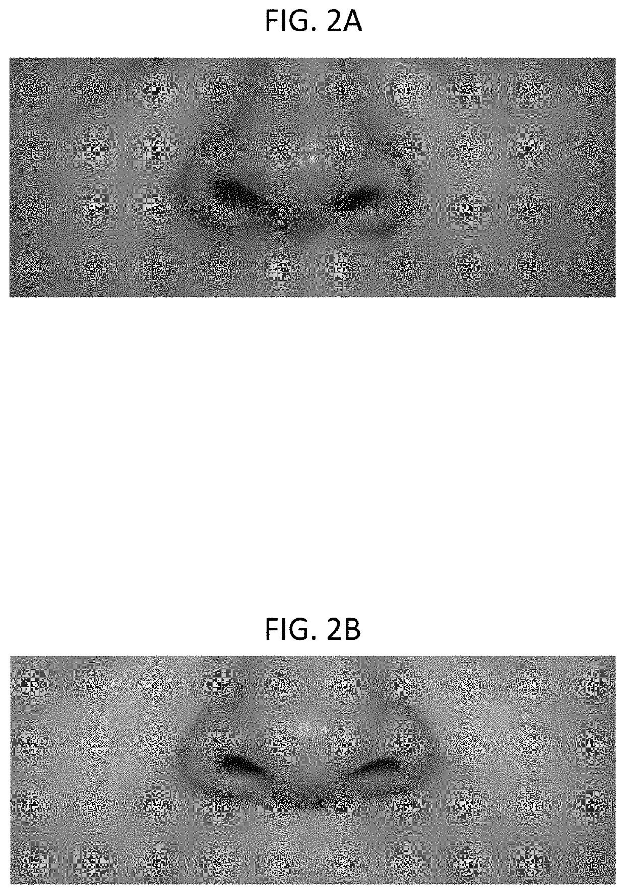 Sterile Buffered Solution Injection to Burn Tissue