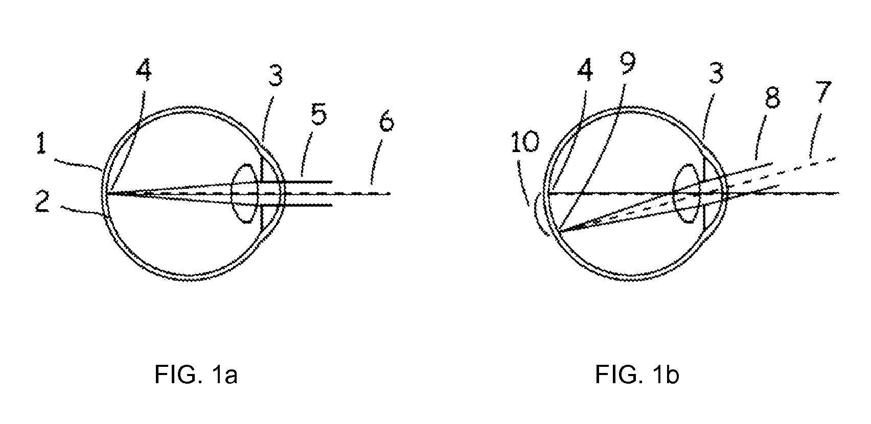 Choroid and retinal imaging and treatment system