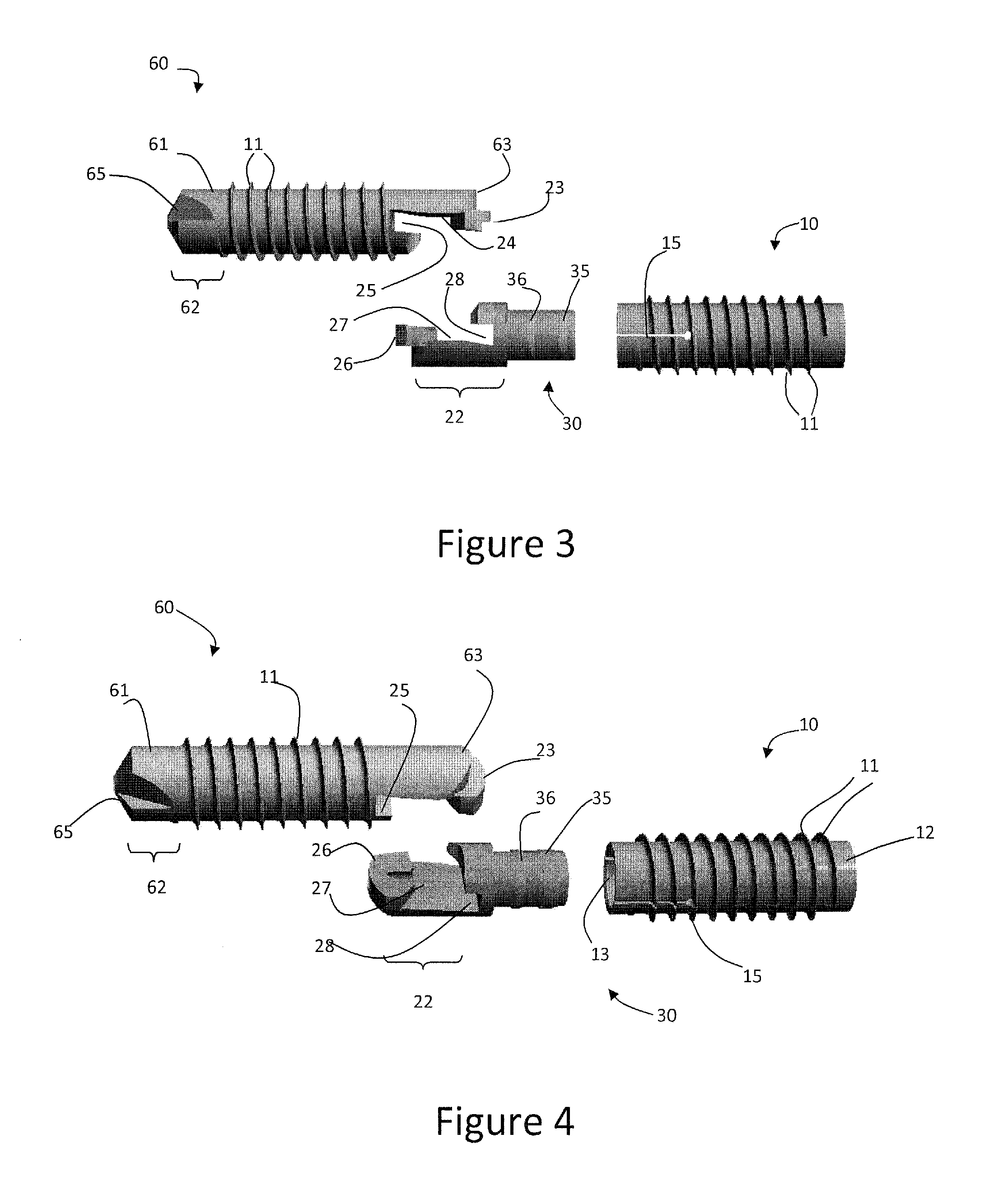 Distal interphalangeal fusion method and device